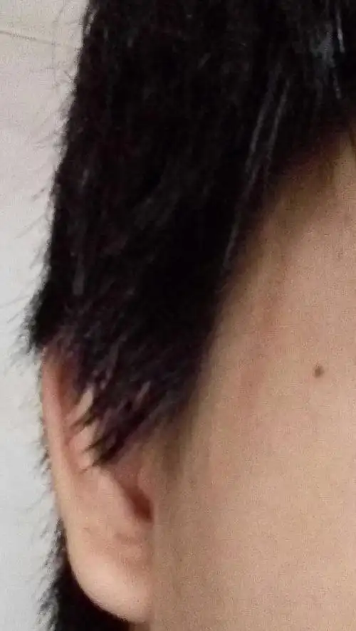 头发鬓角不服帖,往后面长,不能垂直长下来,有什么办法让他垂直长下来?