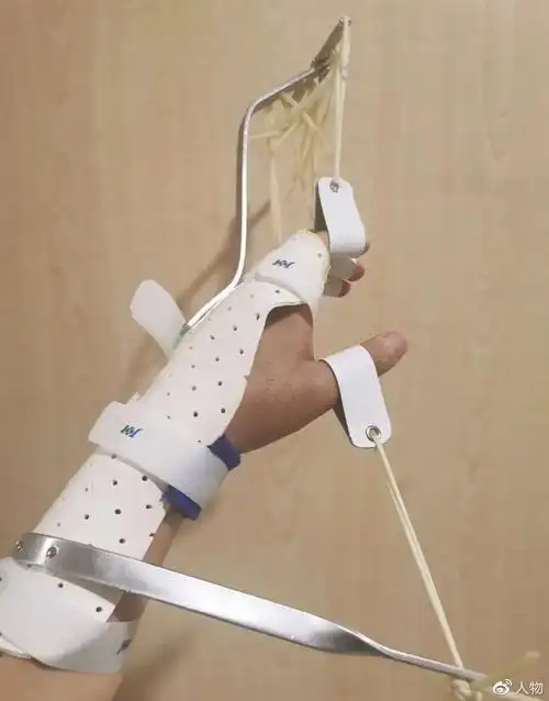 陶勇恢复中的左手