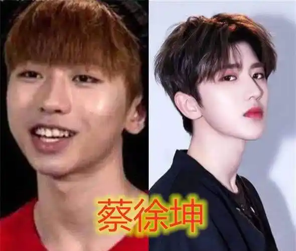 明星整牙堪比整容高圆圆笑得好看全靠牙蔡徐坤胡歌似变了个人