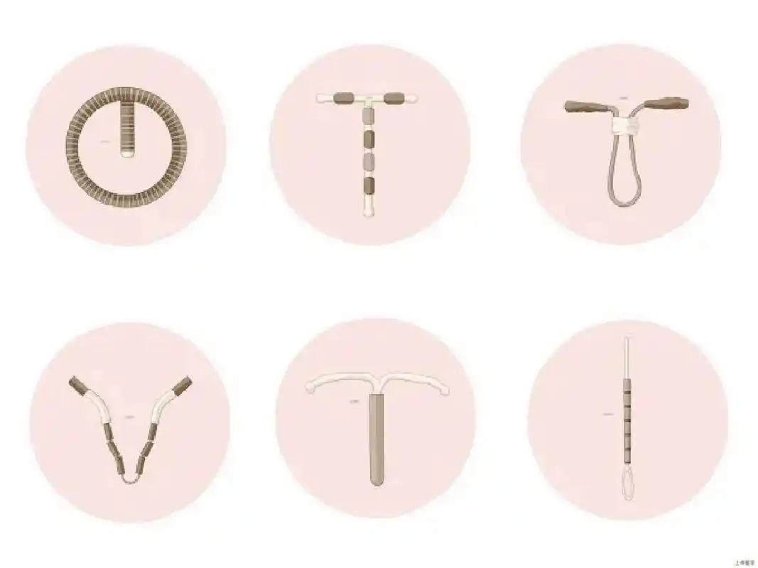 通常宫内节育器超过使用寿命,无论是考虑到避孕效果,还是远期并发症的