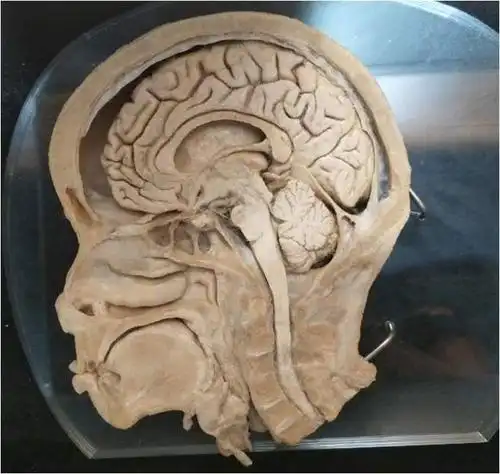 真人捐献的遗体做人体标本胆小勿入