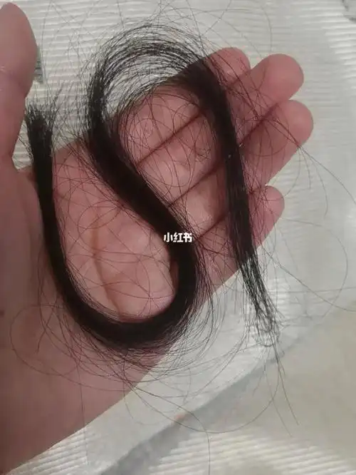 头发一绺一绺的掉啊01
