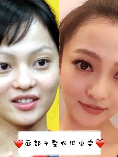 张韶涵实现冻龄不一定要靠整容