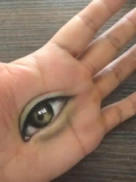 男子一觉醒来发现手掌上长出一只眼睛瞬间不淡定了