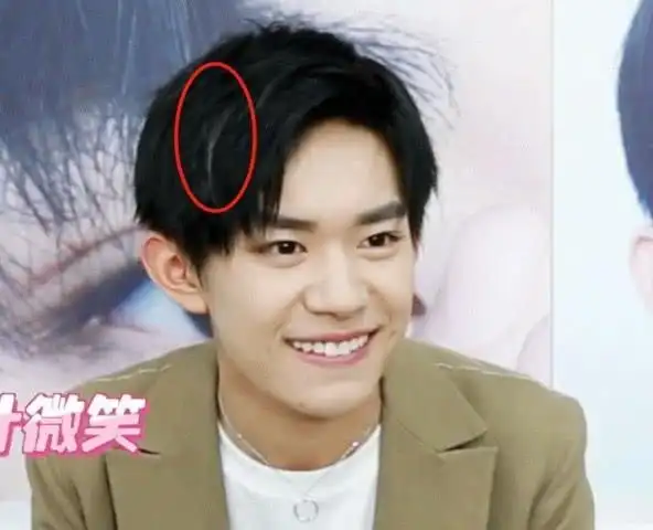 易烊千玺采访时惊现"白头发",高清图放大后,粉丝直呼不敢信