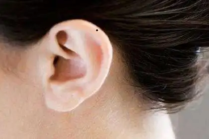 耳朵上有痣的女人具备吸引异性的气质