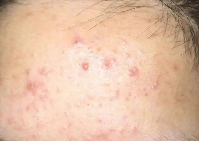 真正肝不好的人,或有这4种情况,了解一下|肠胃|排毒|毒素|胆汁|养肝