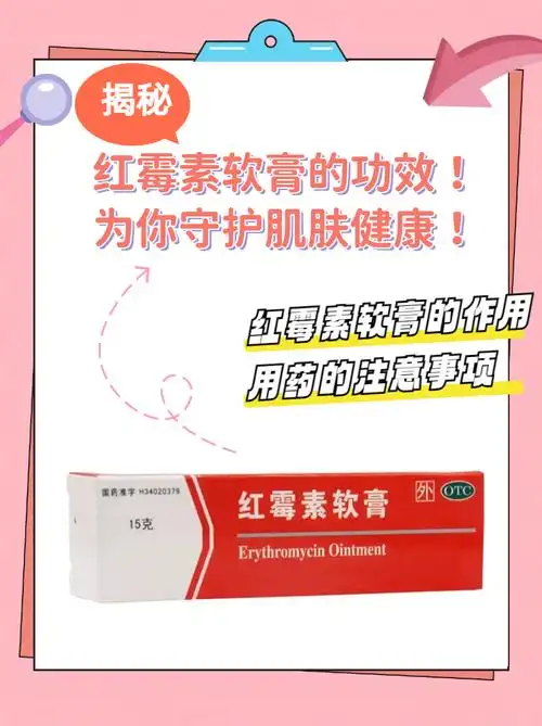揭秘红霉素软膏的功效!为你守护肌肤健康!