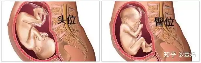 三,b超单上怎么看胎位?