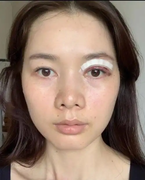 非广告集美们上睑下垂都给我蹲广州华美林