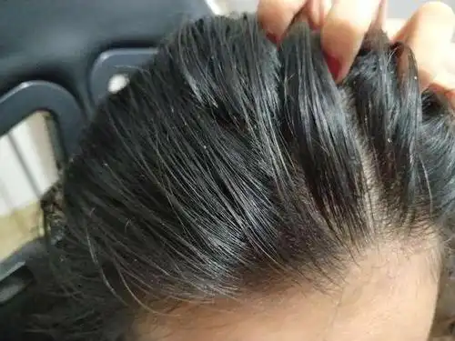 头发出油严重?北风控油洗发水拯救你!用后头发清爽蓬松72小时