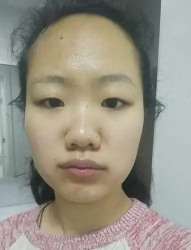 女生蒜头鼻到底好不好啊?鼻梁低鼻子大没活路吗