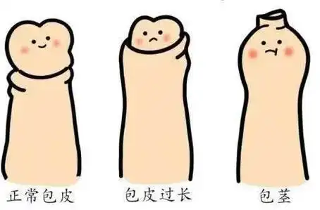 别盲目让"丁丁"历险|包皮环切手术|包皮手术|生理性|包茎|阴茎|-健康