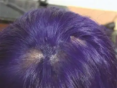 经常来染发的双胞胎姐妹.姐姐的头发染后掉了不少.方龙 摄