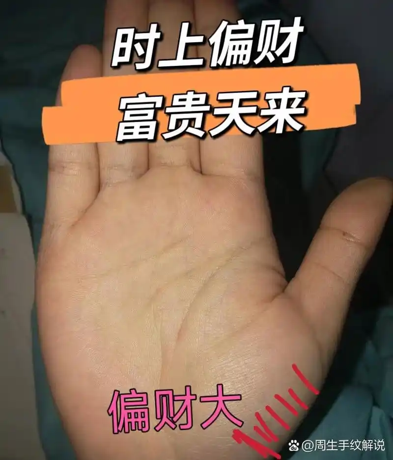 金星丘上面的这种竖纹,越早出现,越早有偏财运