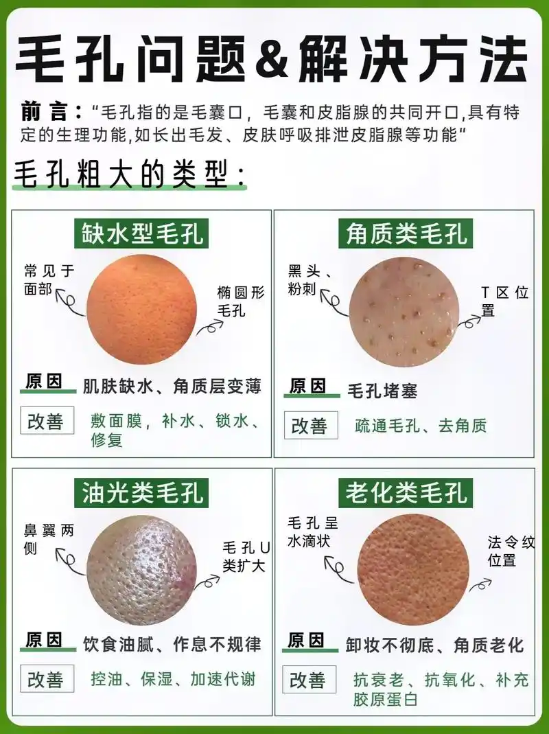 毛孔粗大如何自救71分清类型94正确改善73.