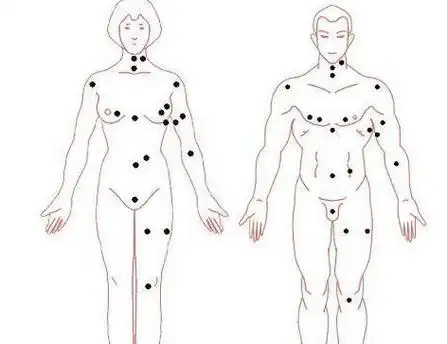 一,乳房正中间长痣在痣相学中,如果一个女人的乳房正中间长痣,她们是