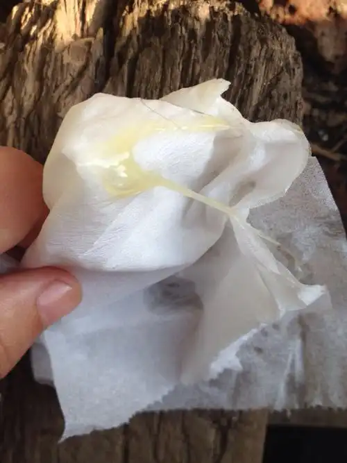 白带是这种得了什么病么?