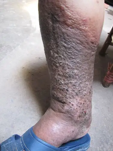 可能涉及到敏感图片,点击后可查看