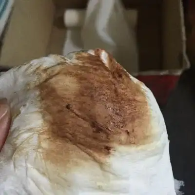 怀孕两个月出现了黑褐色的分泌物,伴有黑色血丝,肚子不痛不疼,腰也不