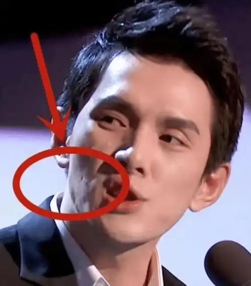 有种"整容"叫李佳琦素颜,关闭10级美颜,脸上痘坑成女生噩梦