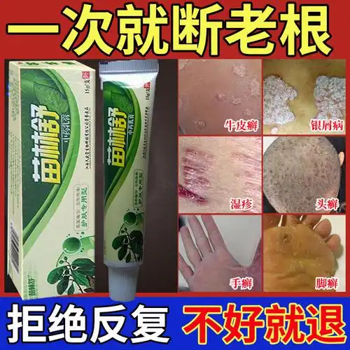 牛皮癣湿疹神经性皮炎汗斑止痒膏药手足藓外用癣疥疮特效药膏已售0