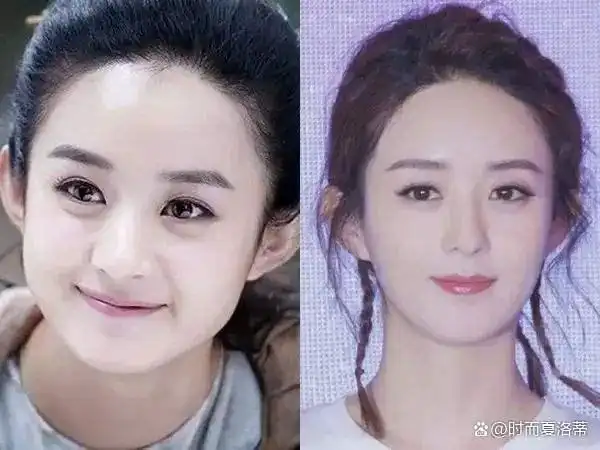 在线测发际线的形状