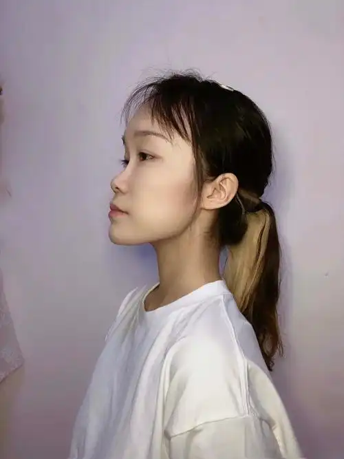 隆鼻术前939393 我的鼻子又塌又扁侧面一看只有鼻头,_圈子-新氧