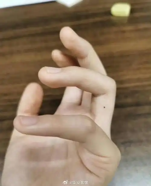 手指突然长痣是好的,是吉痣,多数代表有贵人相助.