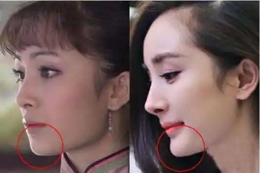 杨幂整容前后照片对比