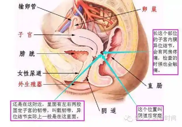 子宫内膜异位症想怀孕,是怀了好,还是不好怀?_月经