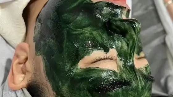 海绵微针"小绿膜"一我的美肤法宝排出毒素,减肤龄,调肤色,理肤质,让你