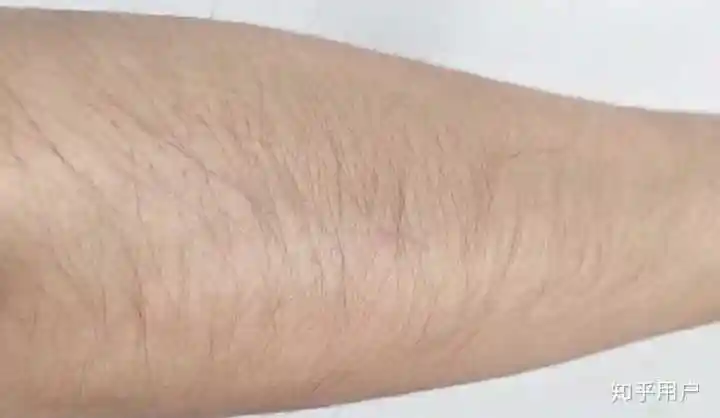 夏天穿短袖,容易露出腋毛怎么办? - 知乎