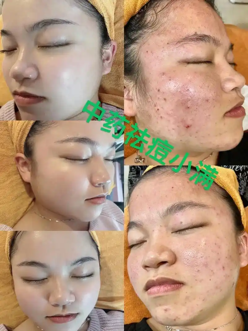 专注问题性皮肤#问题性皮肤管理 - 抖音