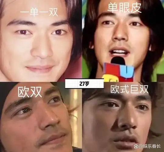 5位割双眼皮的男星就服成龙周星驰没割之前颜值真的太路人