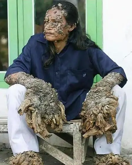 全世界长相最恐怖的人,一个比一个怪异,看到第四个就吐了!