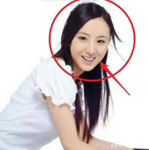 薇娅做手术晒自拍,35岁的素颜状态引关注,脸蛋是否纯天然很显然