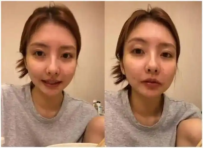 王思聪前女友豆得儿近照曝光,无滤镜状态差变化大!_豆豆_痘痘_网友