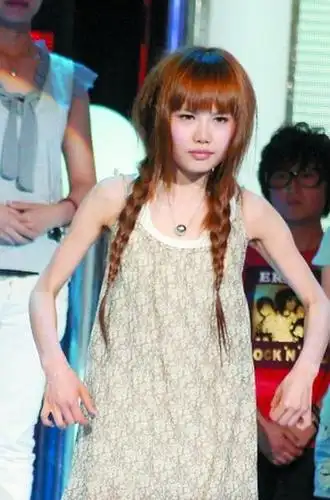 王贝整形 超女王贝整形致死