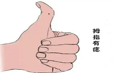 中指长痣代表什么(手指长痣的寓意,哪根手指长痣桃花多?
