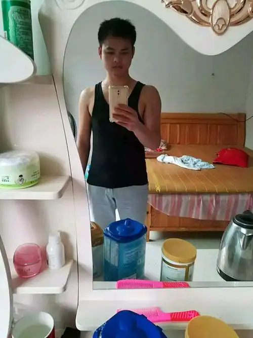 我来自江西宜春,1989年出生,男172厘米,130斤,4年前事故,导致腰骨折