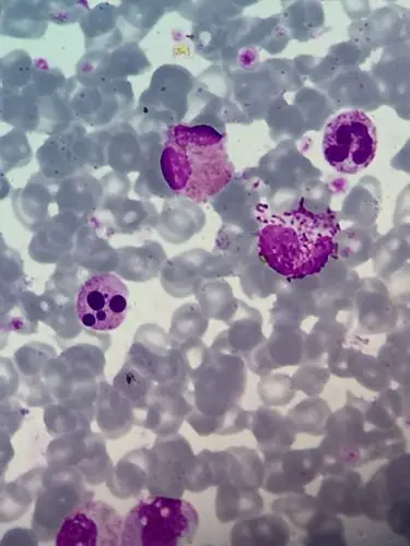 血常规中的细胞 - 美篇