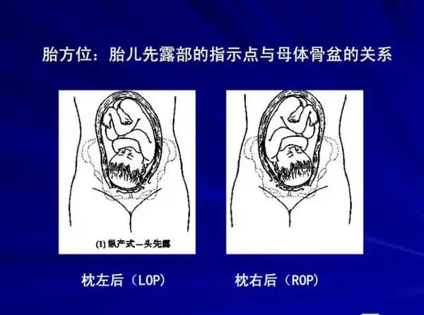 图解胎姿势胎产式胎方位胎先露