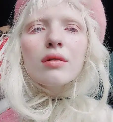 世界上"最白"模特,连眼睫毛都是白的,整个人就像一颗珍珠_网易订阅