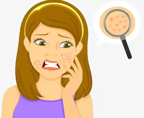 夏季皮肤出油长痘怎么办?做好这几点,轻松解决