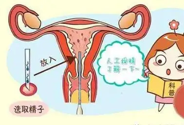 写美篇        人工授精是人类生殖工程领域中实施较早的生殖工程