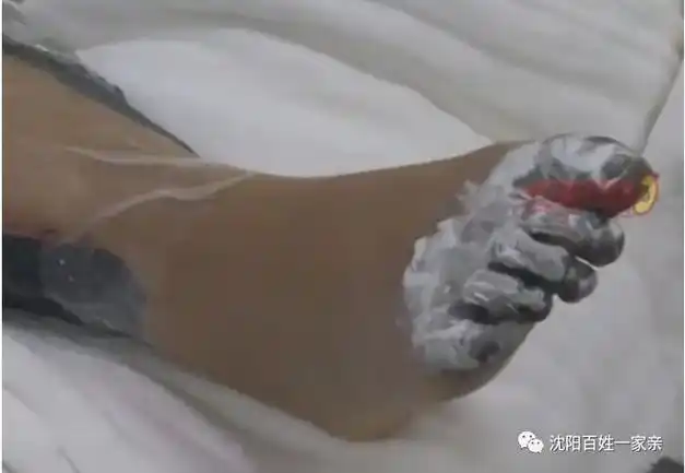 无助!|苹果|大海|电击|截肢|适配器|充电器_网易订阅