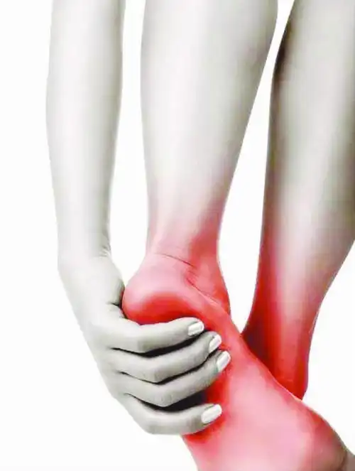 一跑步就脚底痛 小心足底筋膜炎