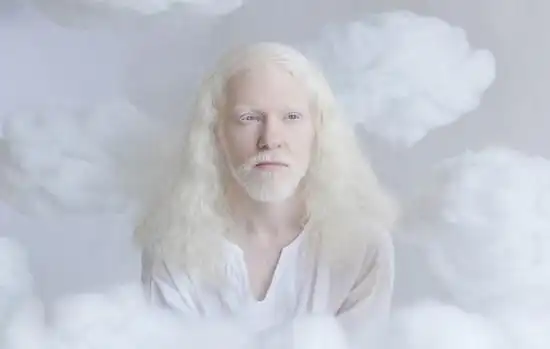 俄摄影师拍摄白化病人 唯美似天使(组图)-新华网