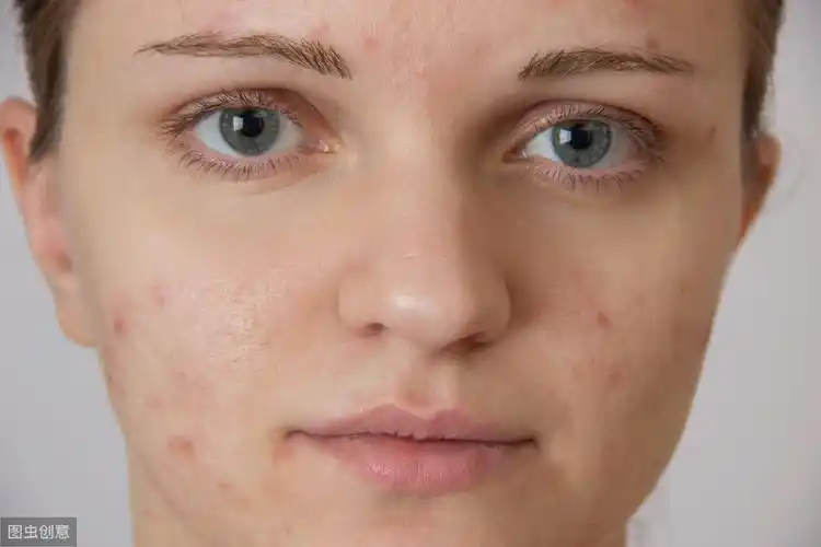 为什么总是肤色暗沉肤色暗沉如何改善可多吃八种食物